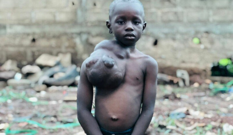 AIDEZ LE PETIT SEYDOU