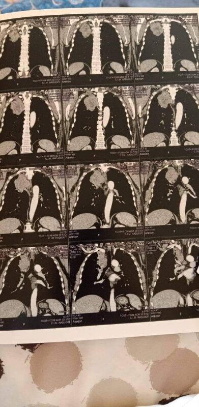 Fundraising proof image