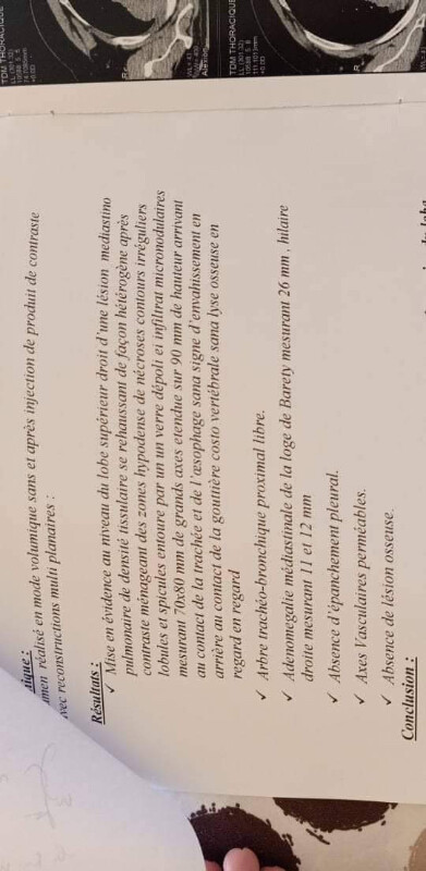 Fundraising proof image