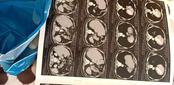Fundraising proof image