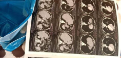 Fundraising proof image