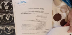 Fundraising proof image