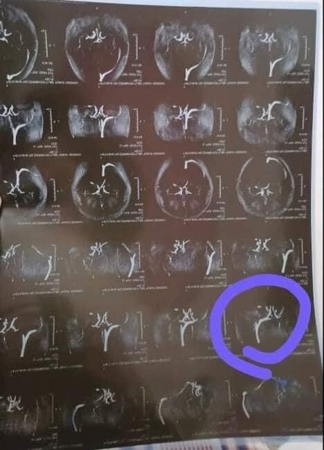 Fundraising proof image