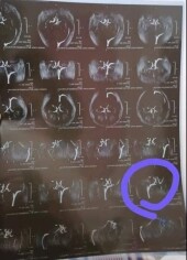 Fundraising proof image