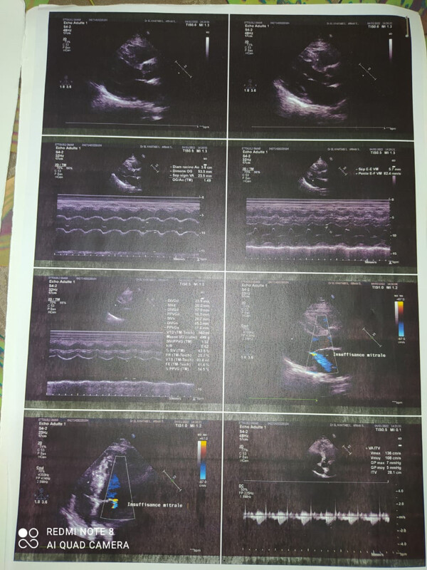 Fundraising proof image