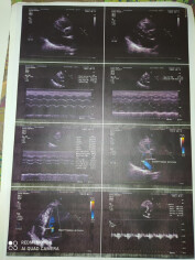 Fundraising proof image