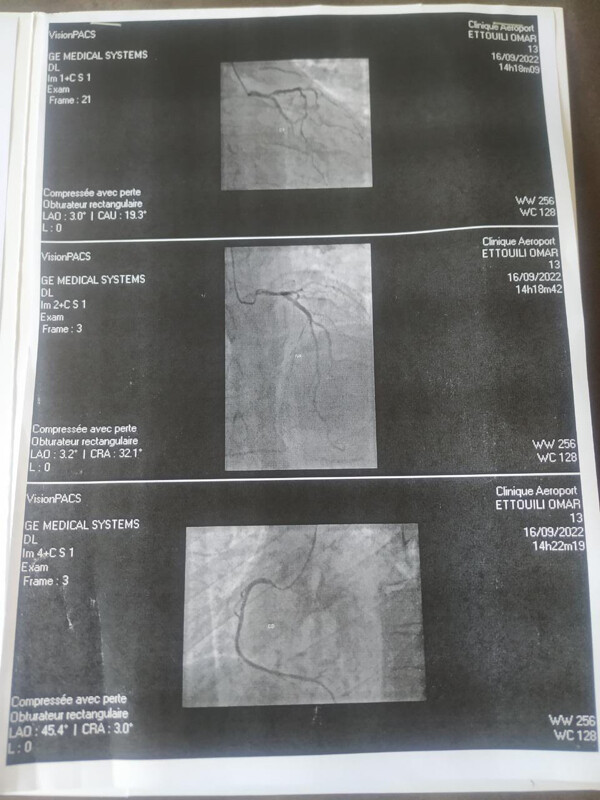 Fundraising proof image