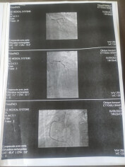Fundraising proof image