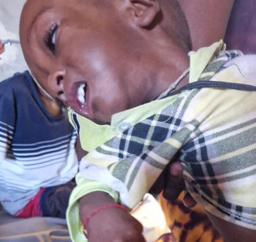 soins pour amadou