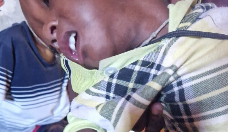 soins pour amadou