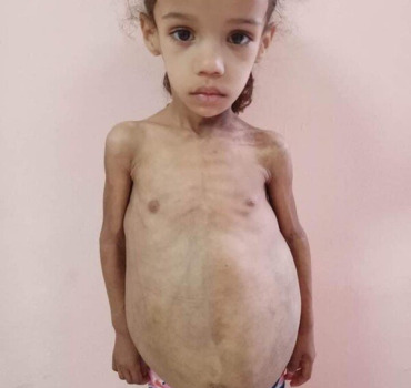 AIDEZ-NOUS À SAUVER DJIHEN 4 ANS.