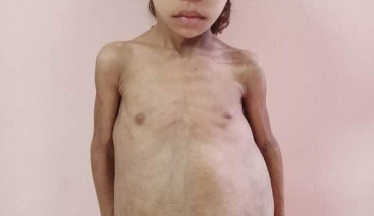 AIDEZ-NOUS À SAUVER DJIHEN 4 ANS.