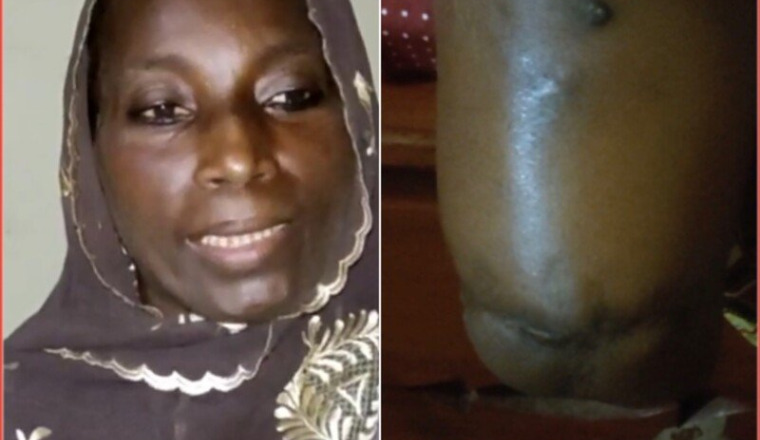 SOS pour Mme Oumou Salamata DIALLO