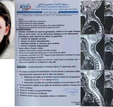 Petite TOUNSSIA atteinte d'une tumeur en Algérie