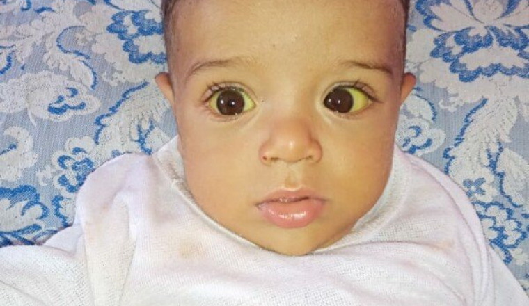 Un foie pour Houssam 👶