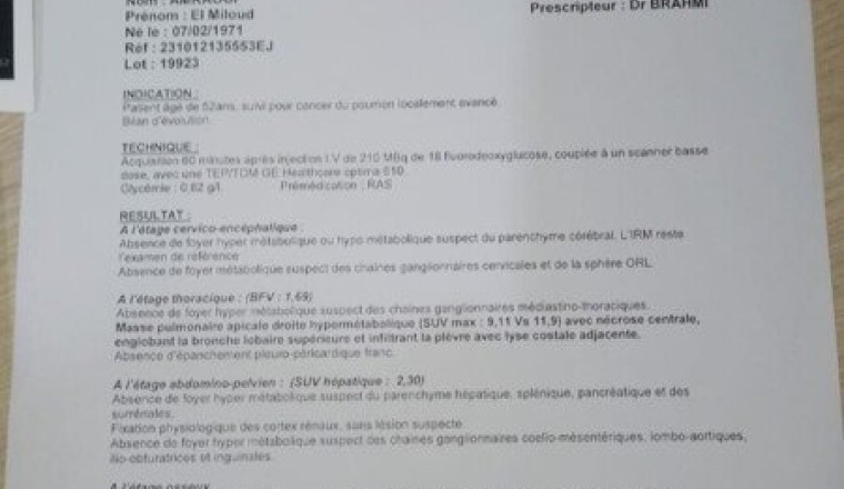 Soins médicaux, chirurgie :cancer pulmonaire