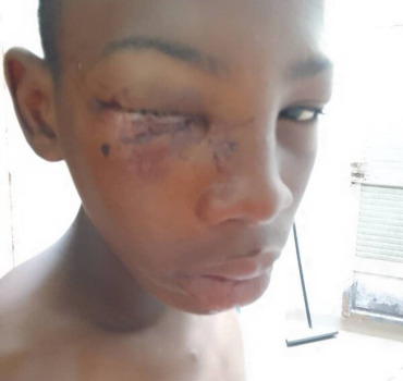 Violenté par un inconnu au Sénégal Abdoulaye Demb