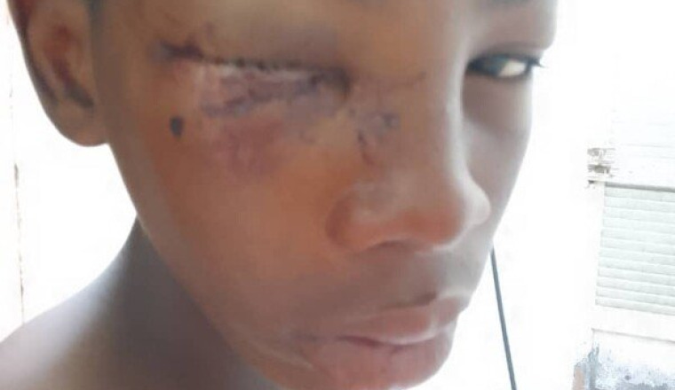 Violenté par un inconnu au Sénégal Abdoulaye Demb