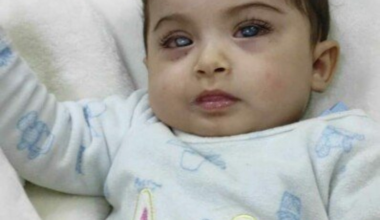 Sauvons les yeux de Khadidja