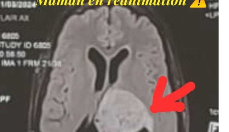 Aidez maman en réanimation après opération cerveau