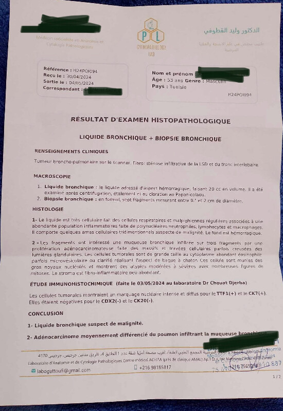 Fundraising proof image