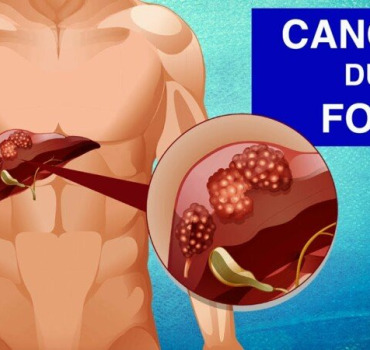 Cancer du Foie aider notre frère MusaMagiraga