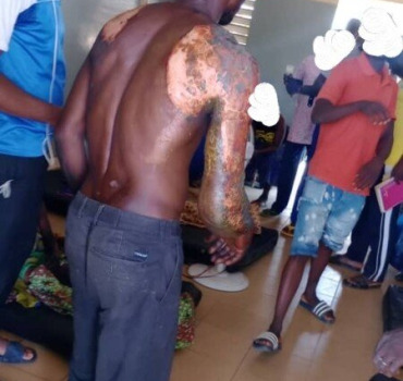 attaque terroriste au Burkina, nos frères brulés.