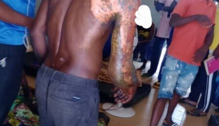 attaque terroriste au Burkina, nos frères brulés.