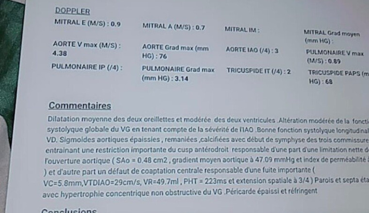 Un nouveau cœur pour notre sœur aida