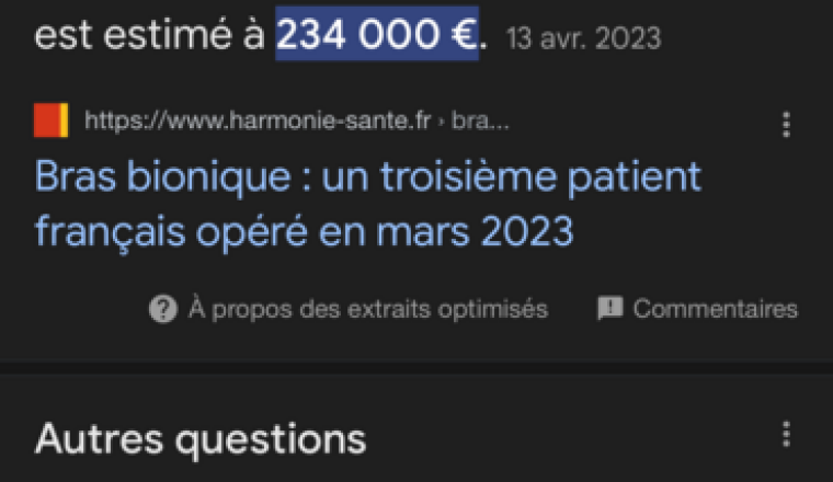 Bras Bionique pour un frère