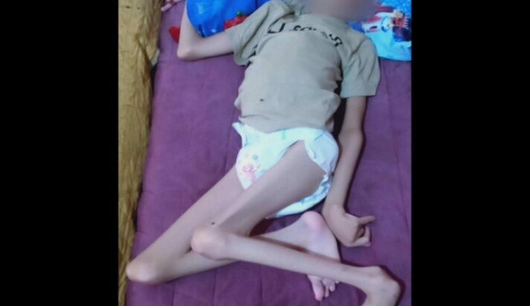 POUSSETTE POUR UN ENFANT HANDICAPÉ DE 13ANS