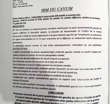 Aide pour payer chimiothérapies et radiothérapie