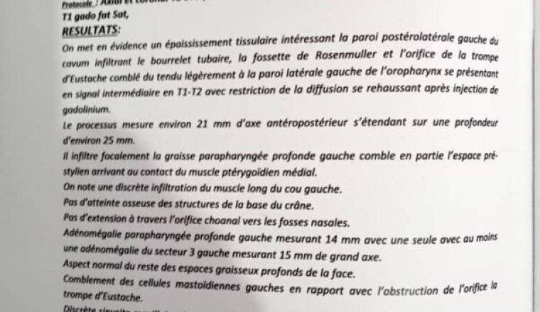 Aide pour payer chimiothérapies et radiothérapie