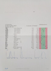 Fundraising proof image