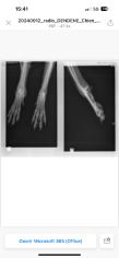 Fundraising proof image