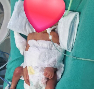 Soutien à notre bébé en réanimation néonatale