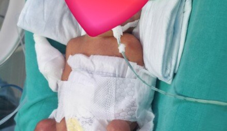 Soutien à notre bébé en réanimation néonatale
