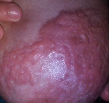 Contre le cancer de Malika