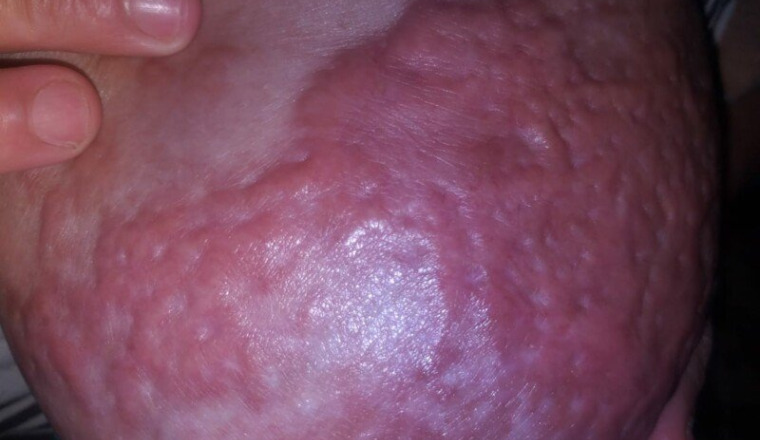 Contre le cancer de Malika