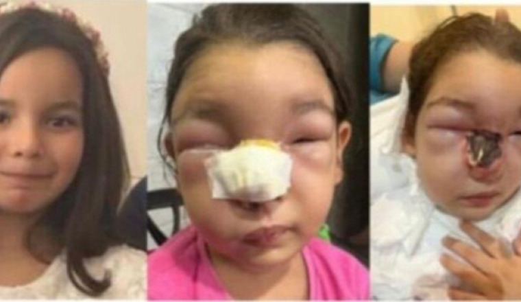 Aider une petite fille atteinte d’un lymphome rare