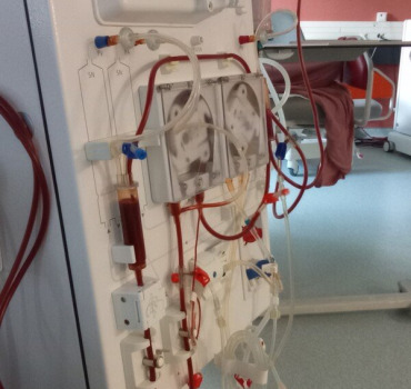 Aide nos frères et sœurs qui fais la dialyse  au c