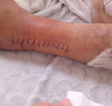 Un accès aux soins pour Abdelouahed