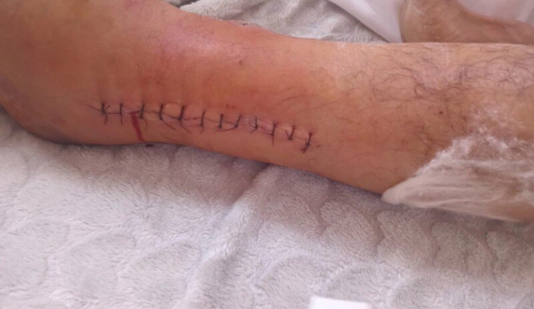 Un accès aux soins pour Abdelouahed