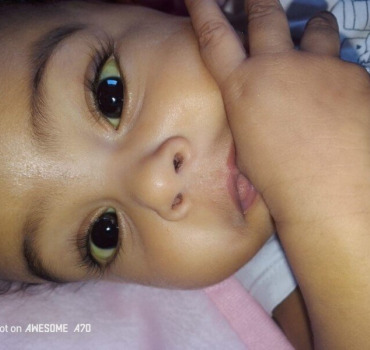 Bébé Yasmine a besoin d’une greffe !
