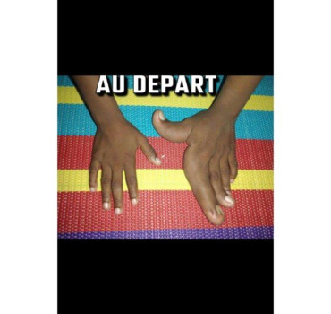 Aidons Maimouna à retrouver l’usage de sa main
