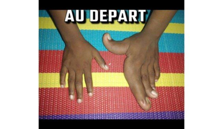 Aidons Maimouna à retrouver l’usage de sa main