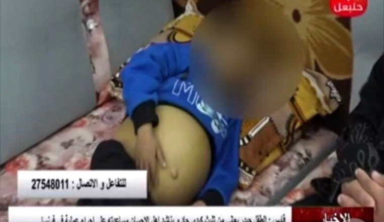 Heydar 5 ans nécessite une greffe de foie