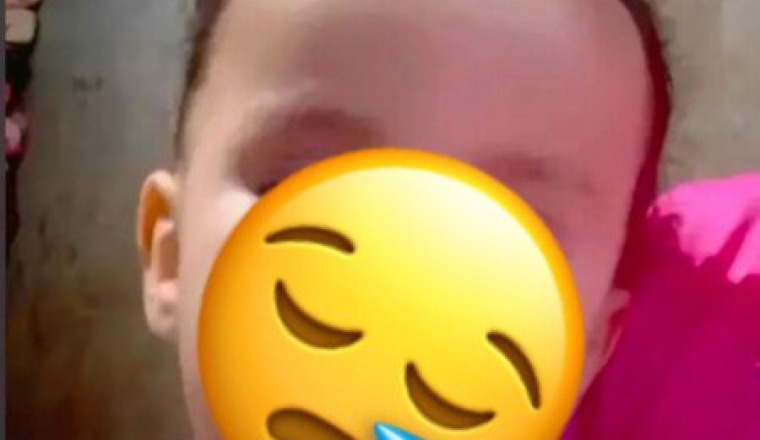Sirine 3 ans doit se faire opérer du cerveaux
