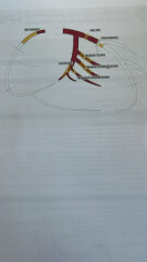 Fundraising proof image
