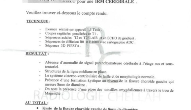 Aide opération kyste cerveau